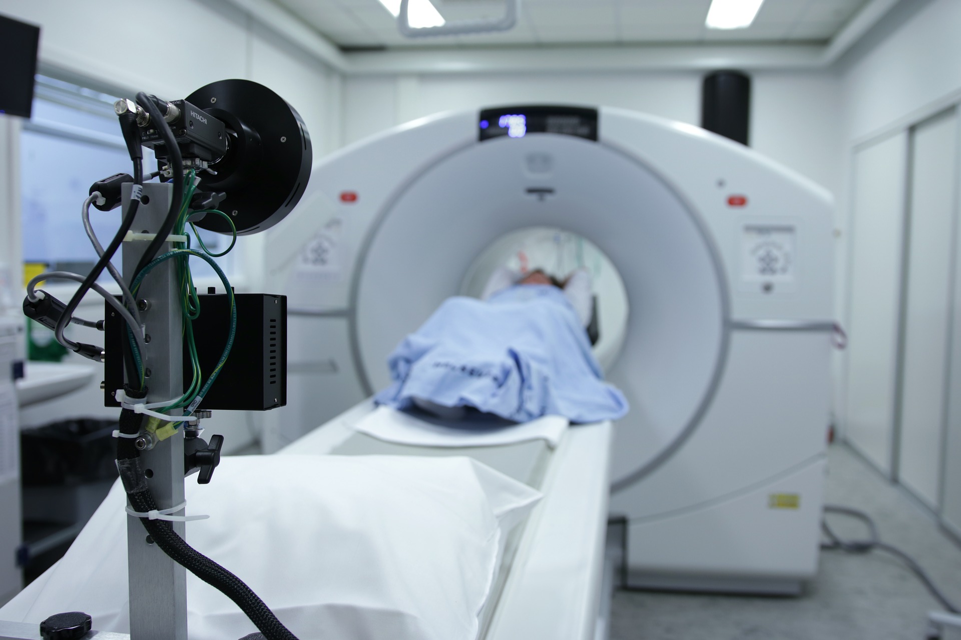 Read more about the article CT Scan