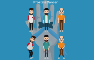 advance Prostate cancer