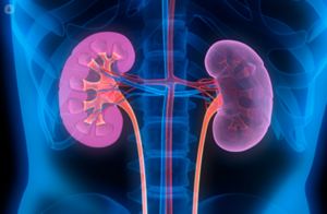 Acute Kidney Infection