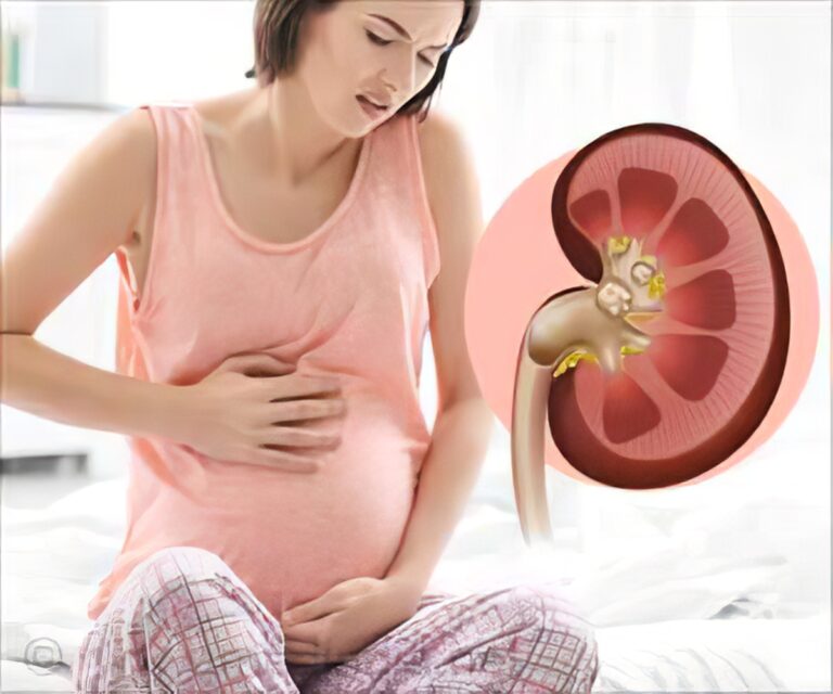 Pregnancy and Kidney Problems